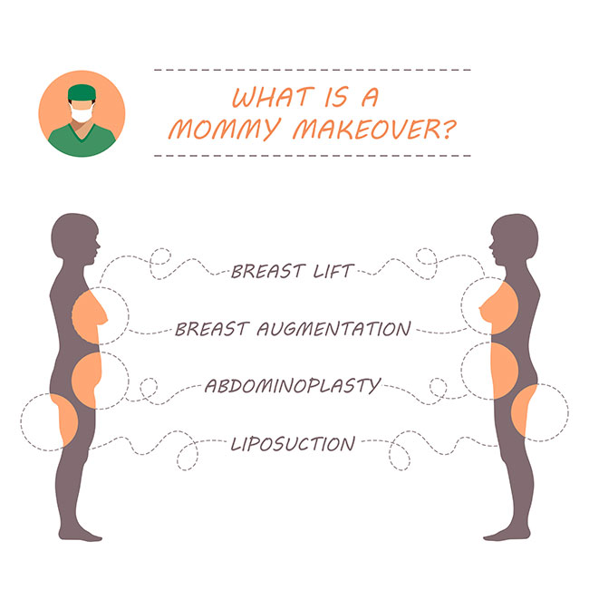 Getting a Mommy Makeover? Here's How To Make Sure Recovery Goes Smoothly -  Pincus Plastic Surgery