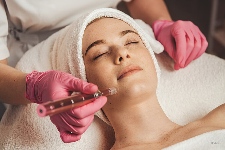 Woman getting Microneedling done