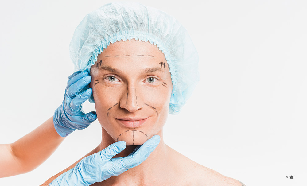 Male with marking on face before getting plastic surgery 