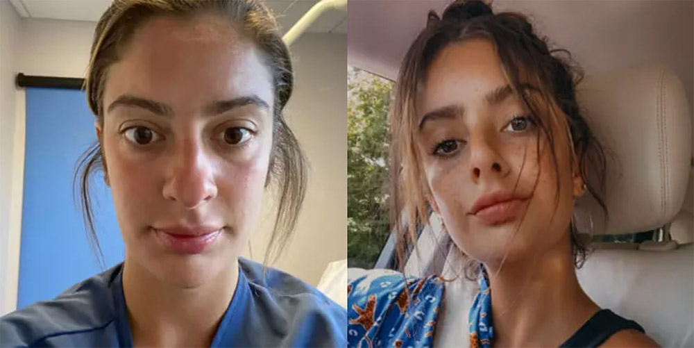 Before and After photo patient